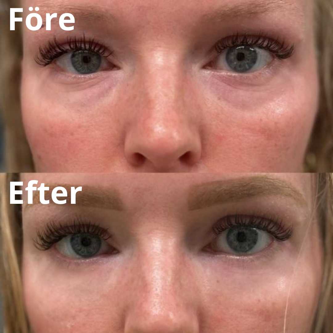 Collagen eyepatches