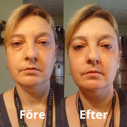 Collagen eyepatches
